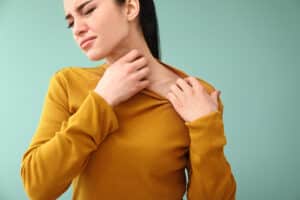 Young woman with chronic hives winces as she scratches her neck